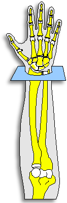 xcwrist.gif - 10.44 kb