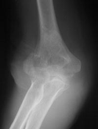 Click for larger image