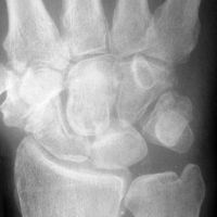 Click to enlarge Highslide