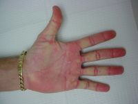 Click to enlarge Highslide