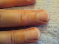 Click to enlarge Highslide